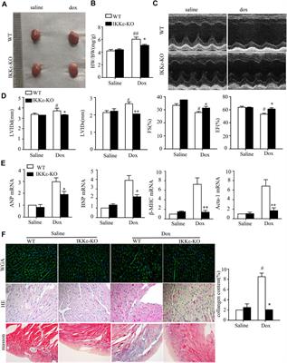 I-κB kinase-ε deficiency improves doxorubicin-induced dilated cardiomyopathy by inhibiting the NF-κB pathway